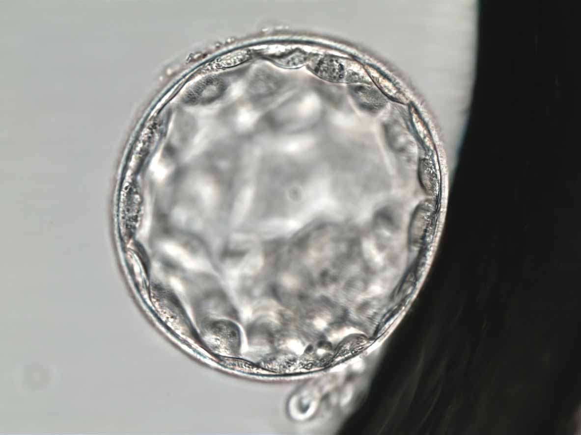 Close-up of a blastocyst-stage embryo under a microscope, prepared for genetic testing during IVF embryo screening
