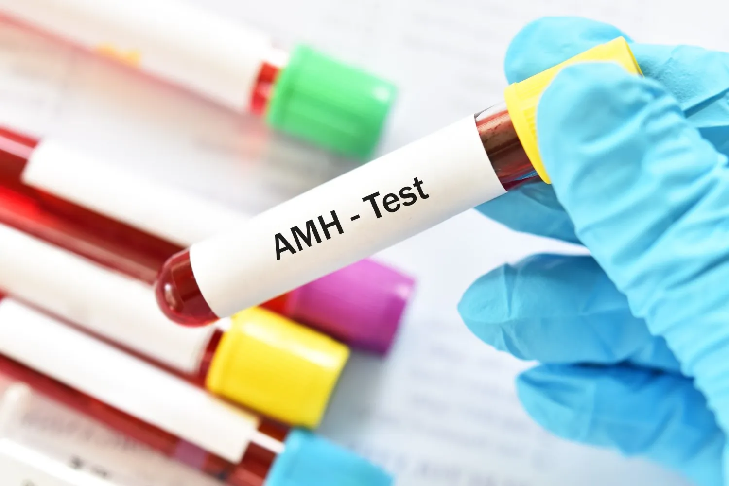 Gloved hand holding one labelled test tube for AMH testing, commonly used to assess ovarian reserve.