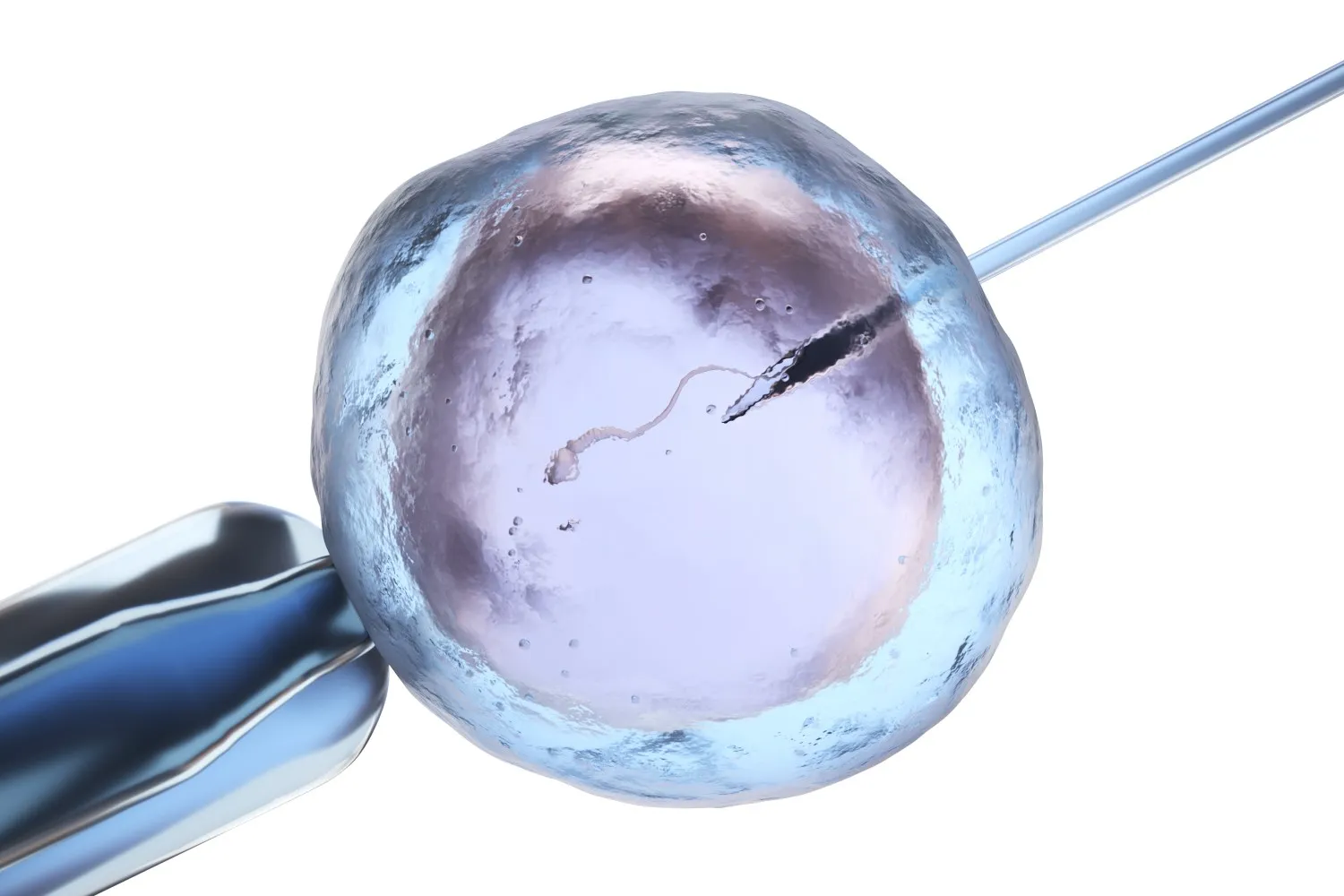  A close-up of an egg being injected on the monitor with sperm during the ICSI process.