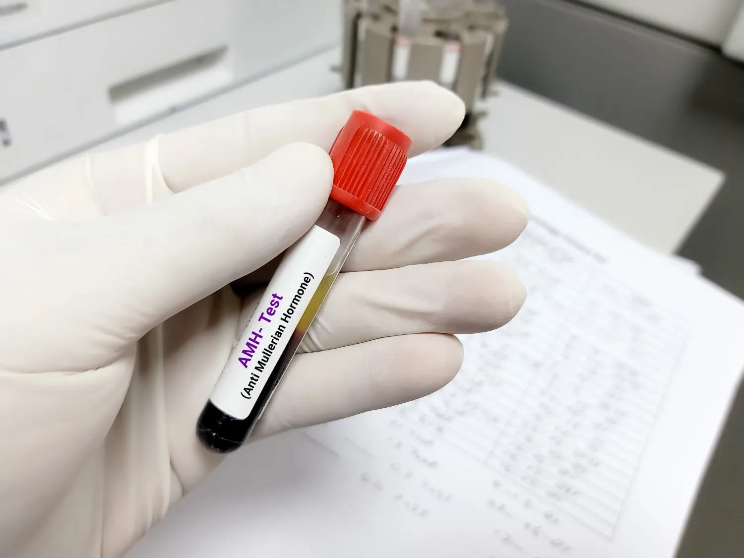 A gloved hand holds a blood sample labelled "AMH Test (Anti-Mullerian Hormone)" in a medical setting. This test is commonly used to assess ovarian reserve and is one of several fertility checks often done before starting an IVF cycle.