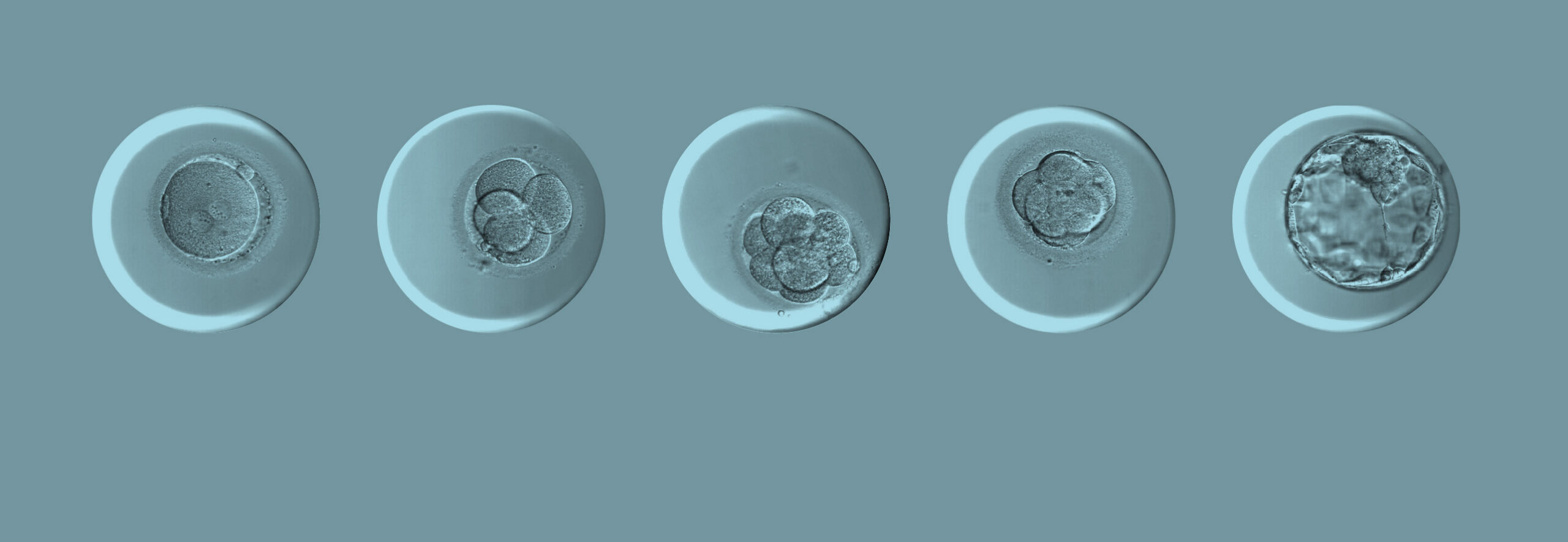Microscope images showing embryos developing to the blastocyst stage during IVF.