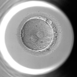 Microscopisch beeld van een bevruchte menselijke eicel op dag 1, met twee pronuclei zichtbaar in de cel voordat deze begint te delen.