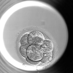 Microscopisch beeld van een menselijk embryo op dag 3 met meerdere cellen die samen geclusterd zijn tijdens de vroege ontwikkeling.