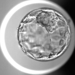 Microscoopbeeld van een blastocyst-embryo, met een embryo in het ontwikkelingsstadium dat meestal wordt bereikt vóór terugplaatsing of invriezing bij IVF.